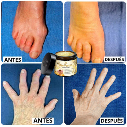CREMA VENENO DE ABEJAS PARA ARTICULACIONES